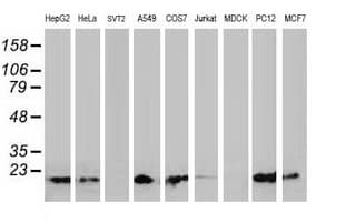 DSTN / Destrin Antibody (clone OTI1C5, Carrier-free)