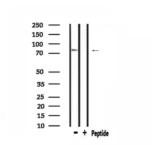 Polyclonal Rabbit anti-Human ADD3 Antibody (IF, WB)