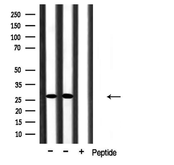 CMTM2 Antibody