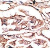 DKK2 Antibody (aa225-251)