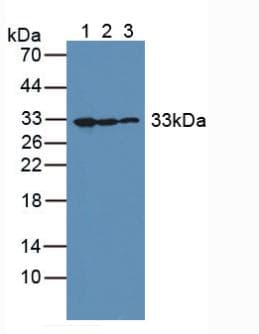GC1qR / C1QBP Antibody (aa76-282)