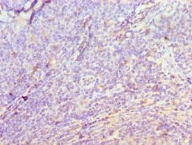 DATF1 / DIDO1 Antibody (aa1-300)