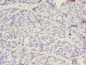 OVCA1 / DPH1 Antibody (aa192-318)
