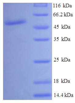 Human GALE / UDP-Glucose 4-Epimerase Protein (Recombinant His-SUMO)