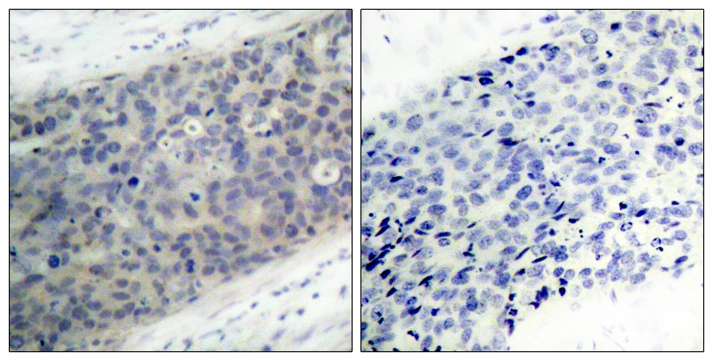 Polyclonal Rabbit anti-Human LIMK2 Antibody (phospho-Thr505, IHC, WB)