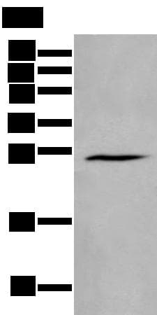 HAND1 Antibody