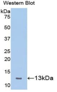 CXCL10 / IP-10 Antibody (aa22-98)
