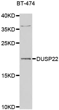 Polyclonal Rabbit anti-Human DUSP22 / JSP 1 Antibody (IHC, IF, WB)