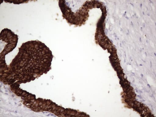 KRT16 / CK16 / Cytokeratin 16 Antibody (clone OTI1G5)