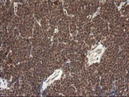 FAM164A / CGI-62 Antibody (clone OTI4B5)
