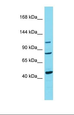 TRPC7 Antibody (C-Terminus)
