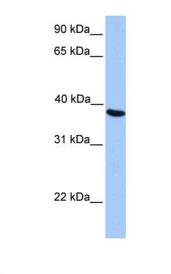 NAT6 / FUS2 Antibody (aa209-258)