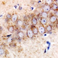 TMED10 / TMP21 Antibody