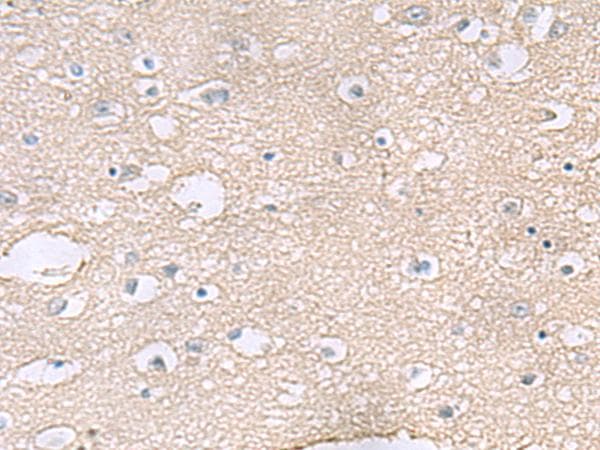 TAGLN3 / Neuronal Protein 22 Antibody