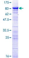 Human DDX56 Protein (Recombinant GST)