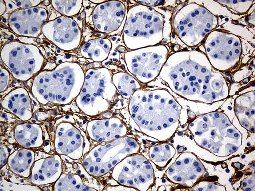 TGFBI Antibody (aa405-683, clone OTI9A11)