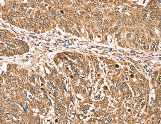 RPLP2 Antibody