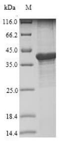 Bartonella henselae LIAS / LIP1 Protein (Recombinant 10His, N-terminus)