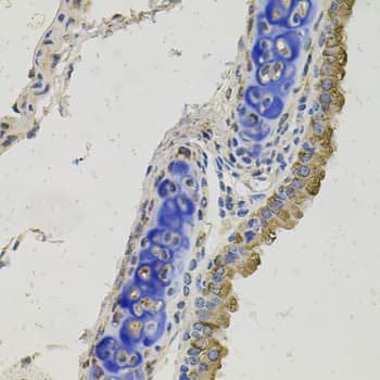 Polyclonal Rabbit anti-Human GAS6 Antibody (IHC, WB)