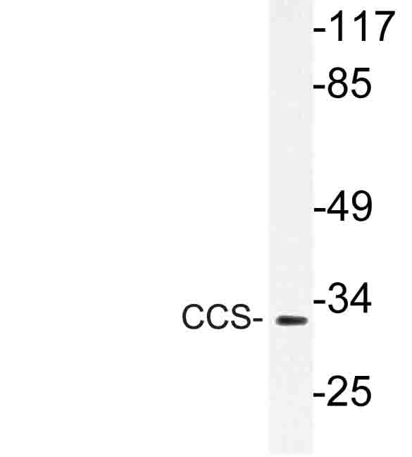 Polyclonal Rabbit anti-Human CCS Antibody (Pro271, WB)