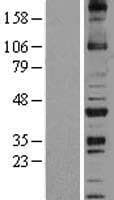 NOXO1 Protein (Over-Expression Lysate Myc-DDK (Flag))