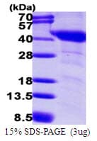 Human GNAI1 / Gi Protein (Recombinant His)