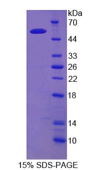 Human EPB42 Protein (Recombinant His-GST)