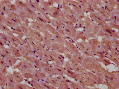 Polyclonal Rabbit anti-Human INPP5E Antibody (IHC, IF)