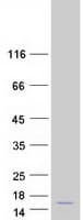 Human HES5 Protein (Recombinant Myc-DDK (Flag))