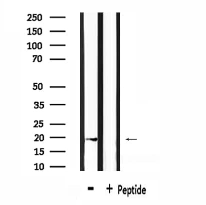 RGS10 Antibody