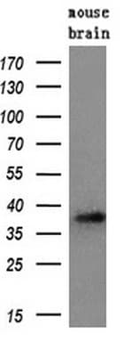 PRTN3 / Myeloblastin Antibody (aa28-248, clone OTI6A10, Carrier-free)