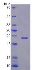 Human RBM3 Protein (Recombinant His-T7)