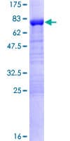 Human DPH2 Protein (Recombinant GST)
