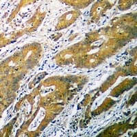 Polyclonal Rabbit anti-Human B4GALT1 Antibody (C-Terminus, IHC, WB)