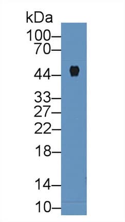 CPB / Carboxypeptidase B Antibody (aa109-415)