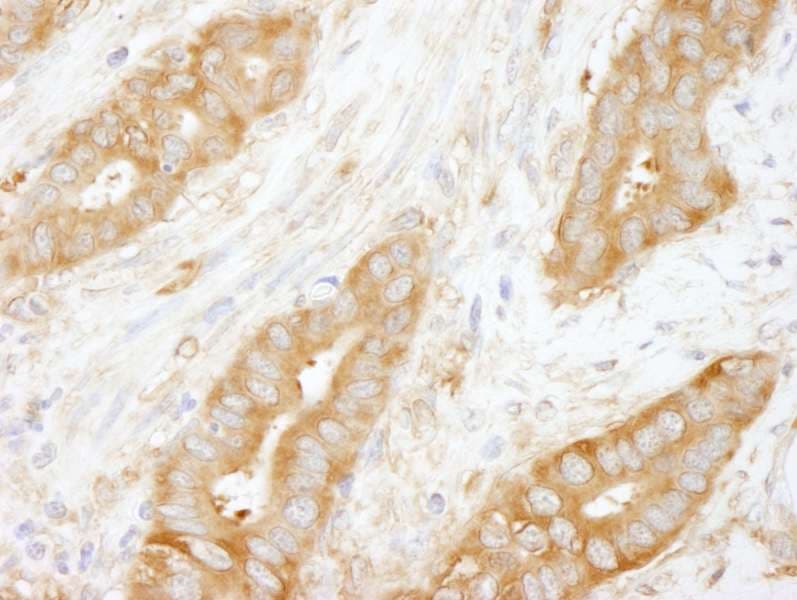 CORO1B Antibody (aa450-489)