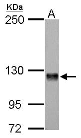 Polyclonal Rabbit anti-Human AMPH / Amphiphysin Antibody (aa1-194, IHC, WB)