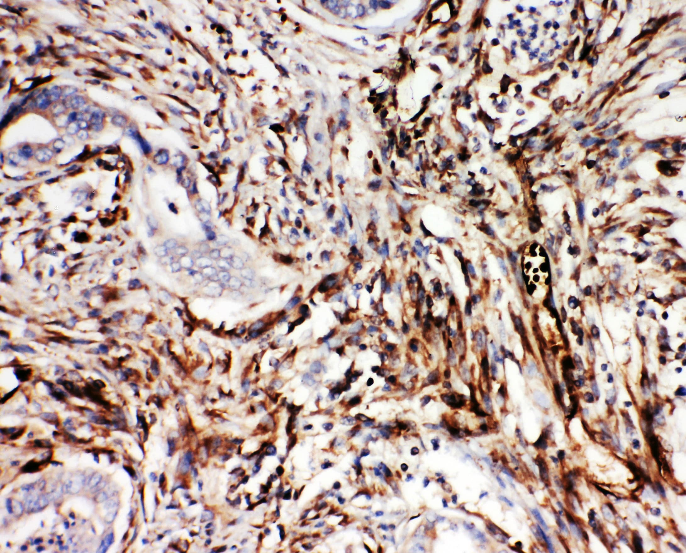 NRG1 / Heregulin / Neuregulin Antibody (aa617-636)