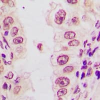Polyclonal Rabbit anti-Human C/EBP Alpha / CEBPA Antibody (IHC, WB)