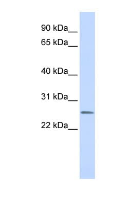 CEACAM4 Antibody (aa36-85)