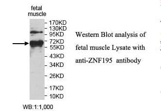 Polyclonal Rabbit anti-Human ZNF195 Antibody (aa379-597, IHC, WB)