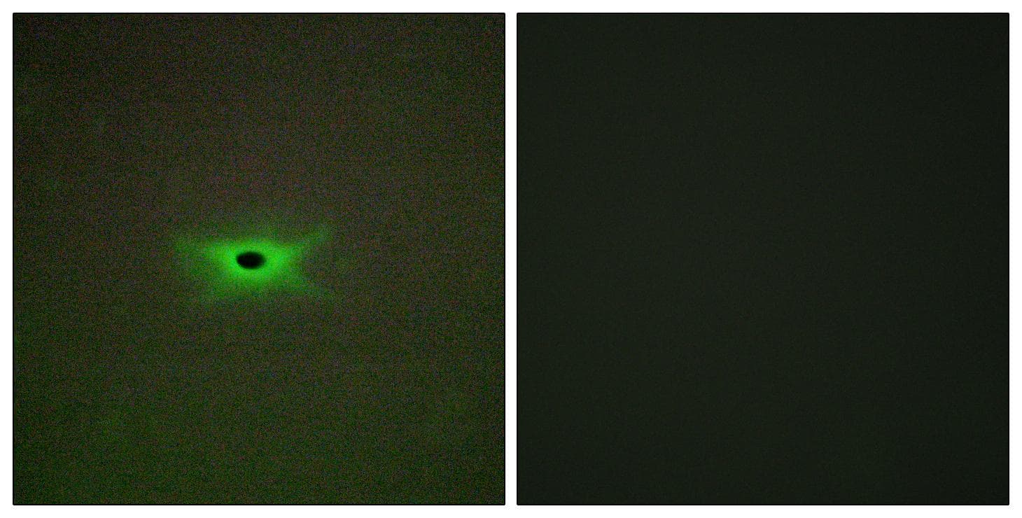 PRKAG2 / AMPK Gamma 2 Antibody