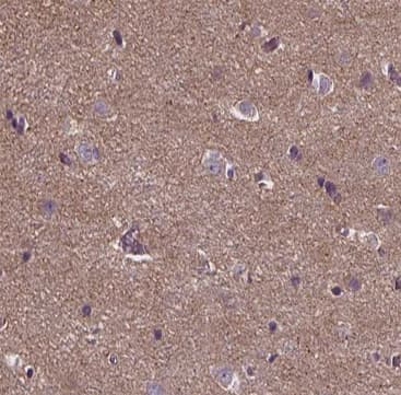 ANKRD26 Antibody