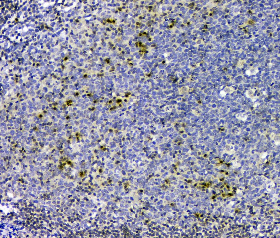 CDKN1B / p27 Kip1 Antibody (aa10-198)