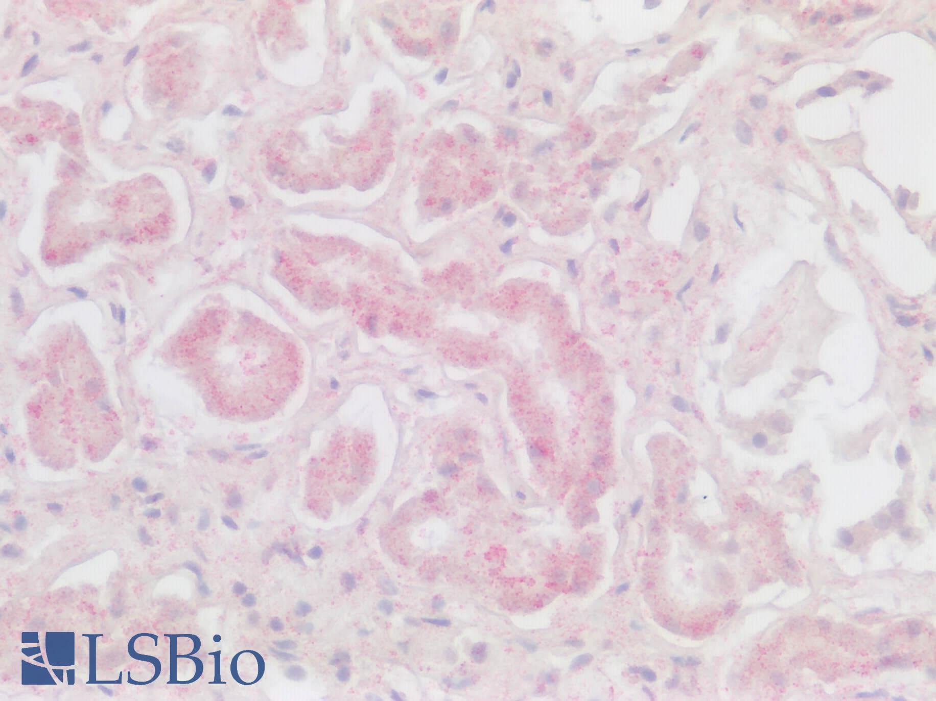 IHC-plus™ Polyclonal Rabbit anti-Human CXCR6 Antibody (Cytoplasmic Domain, IHC)