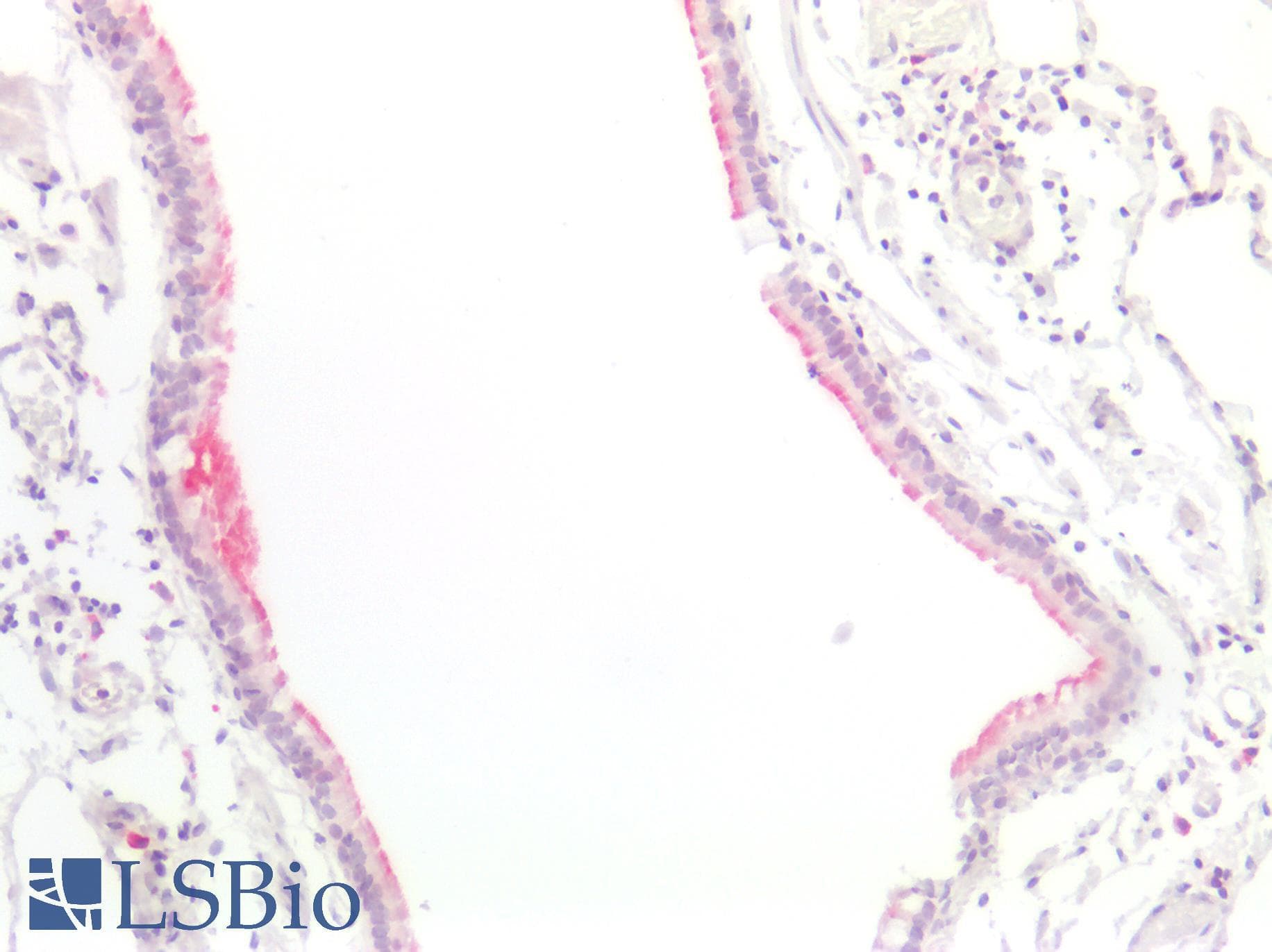 PathPlus™ FLG / Filaggrin Antibody (N-Terminus)