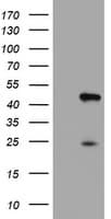 CENPH / CENP-H Antibody (clone OTI1C2)