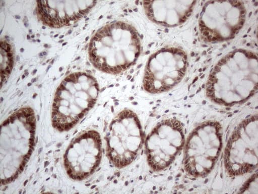 IRS1 Antibody (aa1-280, clone OTI9E11)