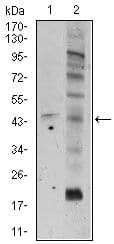 FZD5 / Frizzled 5 Antibody (Amino Acid: 151-217, clone 2D12)