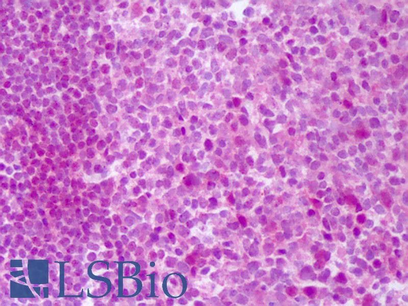 IHC-plus™ Polyclonal Rabbit anti-Human TNFSF15 / TL1A / VEGI Antibody (IHC, WB)